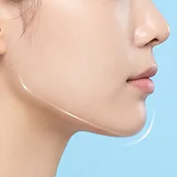 小顔整形フルサポートのイメージ