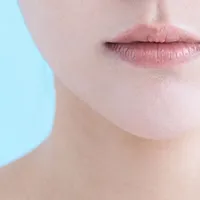 スレッドリフトのイメージ